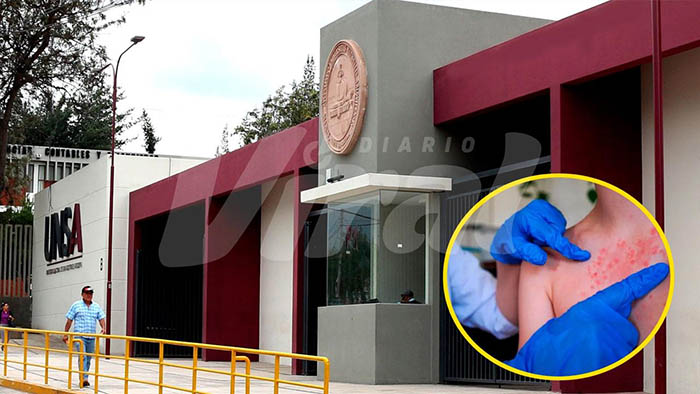 Arequipa: UNSA suspende clases presenciales en tres facultades por casos de sarampión